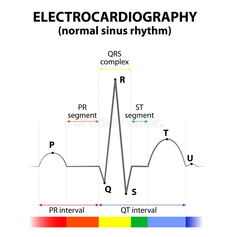 ECG of a heart in normal sinus rhythm. Schematic representation. wave and segment names