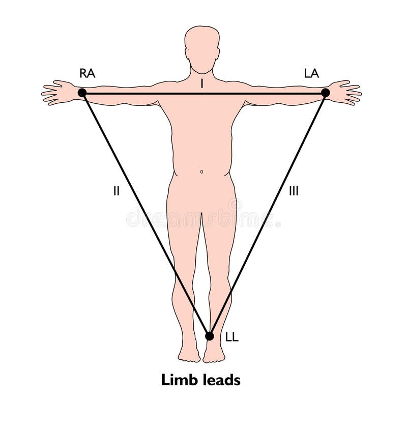 ECG limb leads