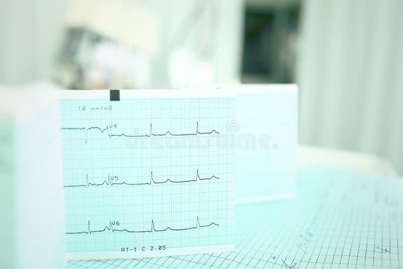 ECG på doktorstabellen royaltyfria bilder ECG på doktorstabellen royaltyfria bilder