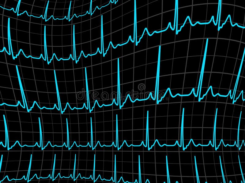 ECG tracing monitor. EPS 8