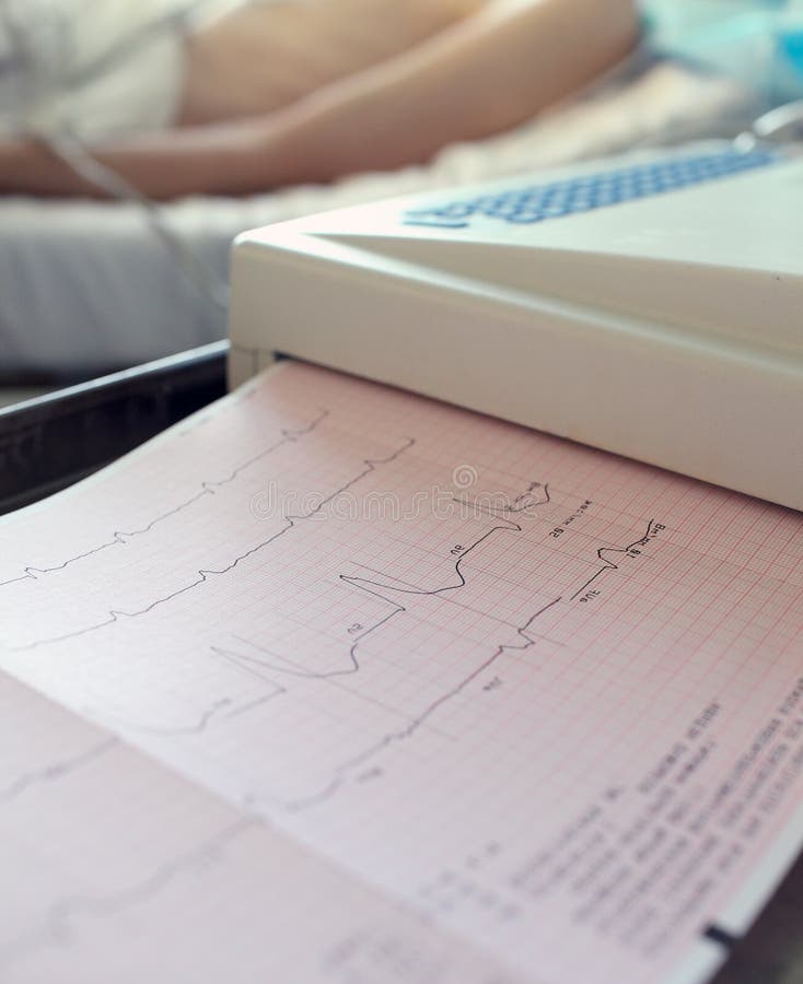 ECG-utskrift av den tålmodig stock illustrationer ECG-utskrift av den tålmodig stock illustrationer