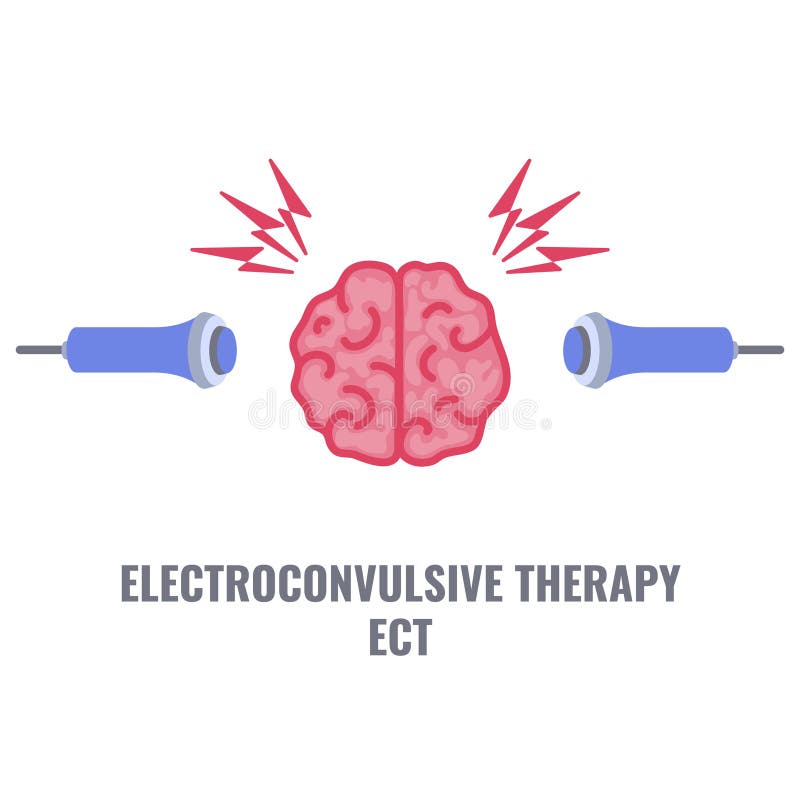 Electroconvulsive Therapy Stock Illustrations 47 Electroconvulsive