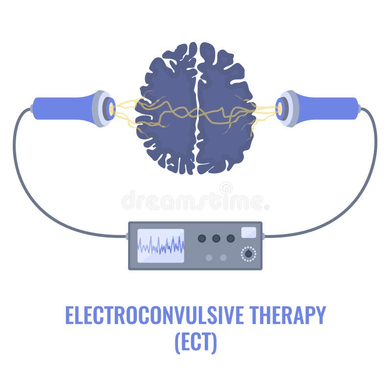 Electroconvulsive Therapy Stock Illustrations 47 Electroconvulsive