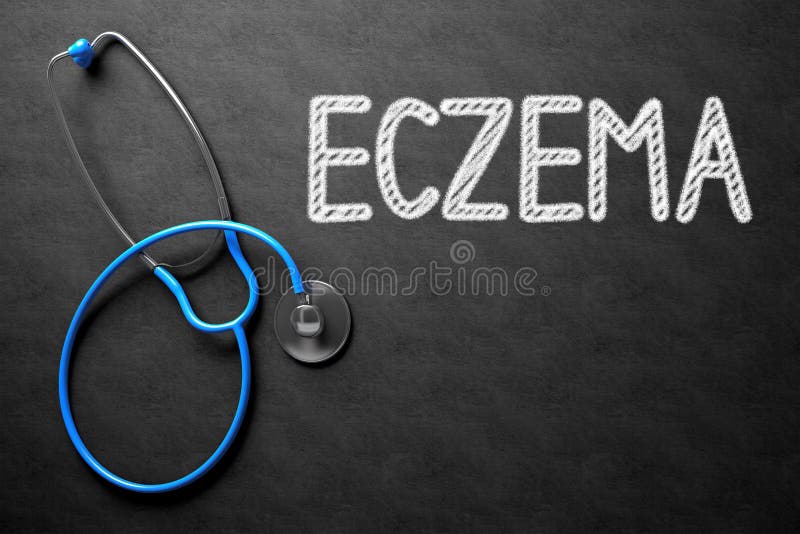 Medical Concept: Eczema Handwritten on Black Chalkboard. Medical Concept: Eczema on Black Chalkboard. 3D Rendering. Medical Concept: Eczema Handwritten on Black Chalkboard. Medical Concept: Eczema on Black Chalkboard. 3D Rendering.