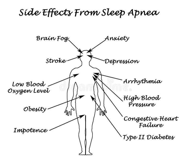 Efectos del Apnea de sueño