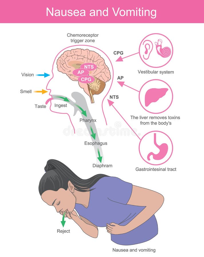 Effect Of Brain Processes Stock Illustration Illustration Of Medical how-to-avoid-throwing-up-sinkforce15