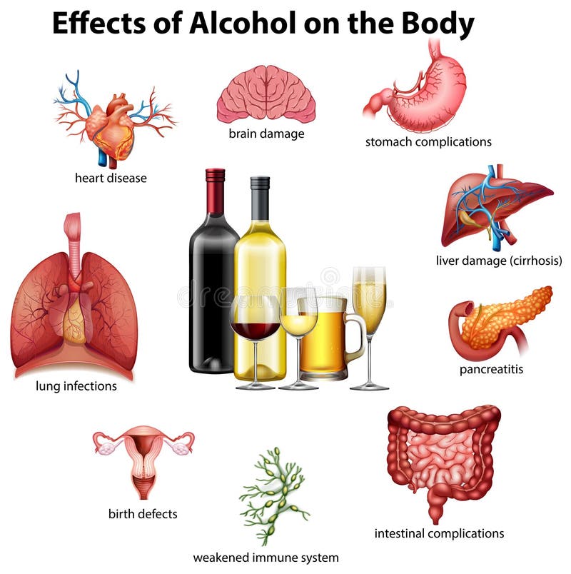 Effects of Alcohol on the Body Stock Vector Illustration of