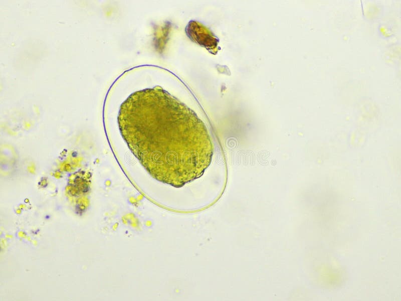 Egg of Hookworm in Human Stool Stock Photo - Image of fluke, laboratory