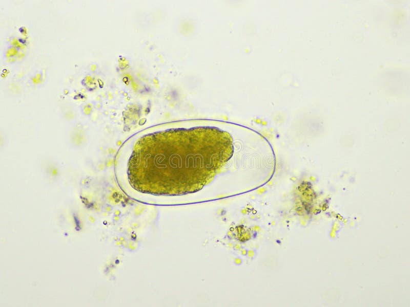 Egg of Hookworm in Human Stool Stock Image - Image of medical, analyze
