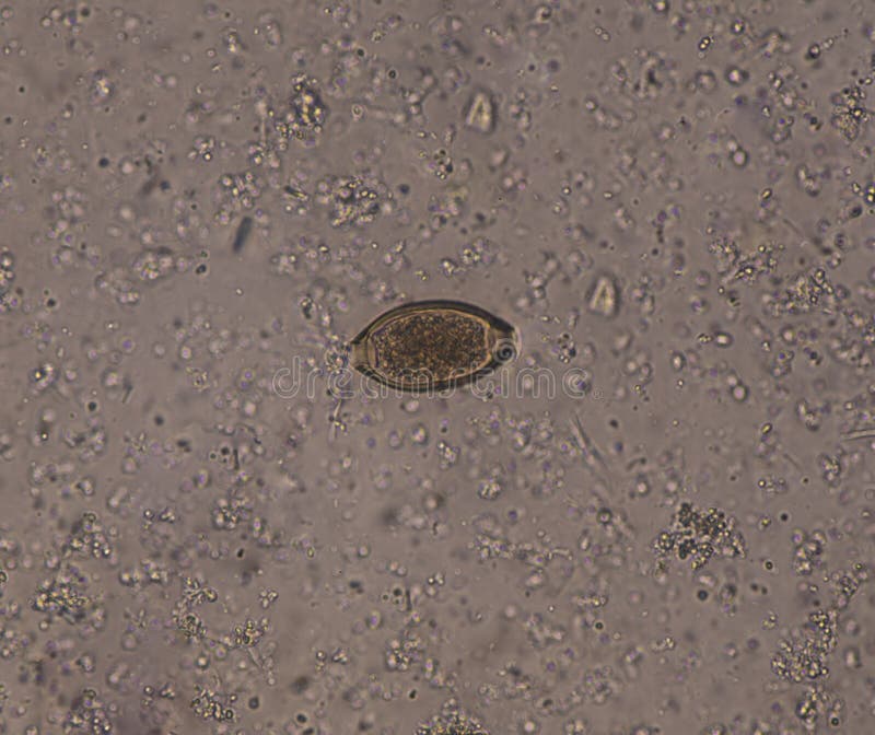 Egg parasite in stool exam stock photo. Image of eggs 178624024