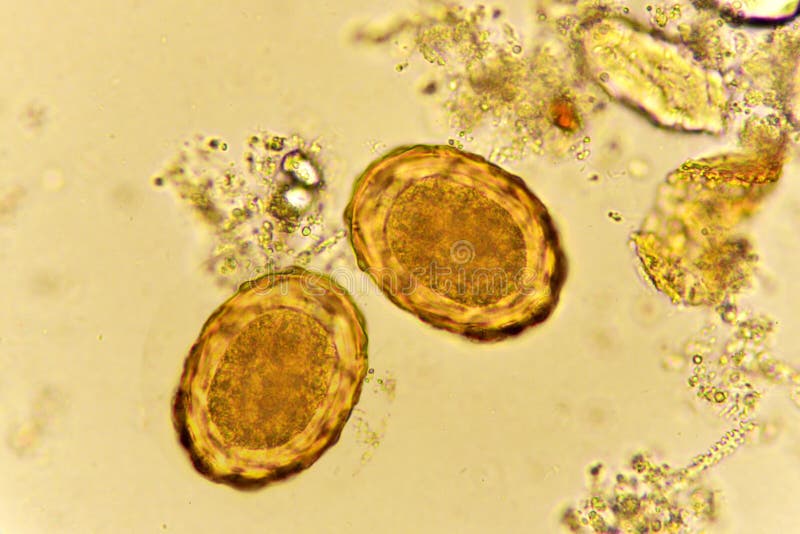Eggs of Ascaris Lumbricoides in Stool Stock Photo Image of micro