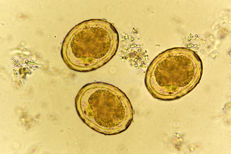 Ascaris Lumbricoides Microscope