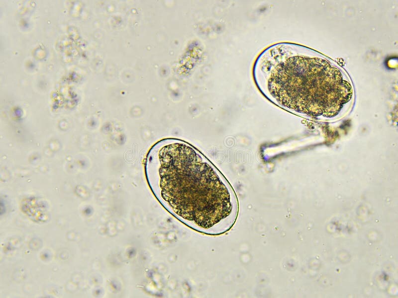 flat worm eggs flat worm eggs