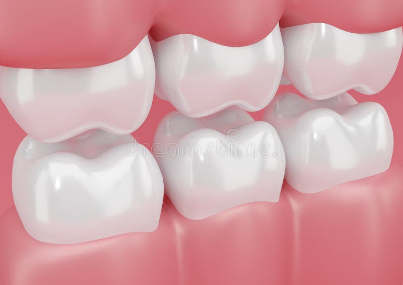 Ejemplo 3D De La Arcada Dental Humana Stock de ilustración