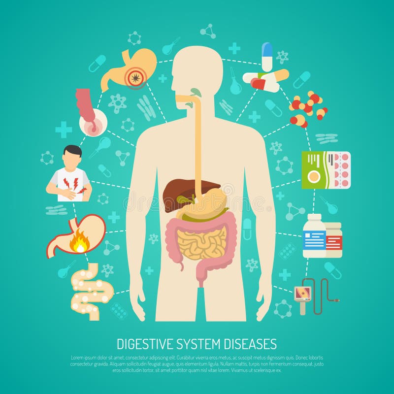 Ejemplo de las enfermedades del sistema digestivo ilustración del vector Ejemplo de las enfermedades del sistema digestivo ilustración del vector