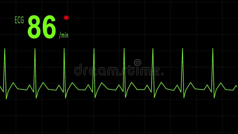 EKG animation heartbeat stock video. Video of listening - 39110377