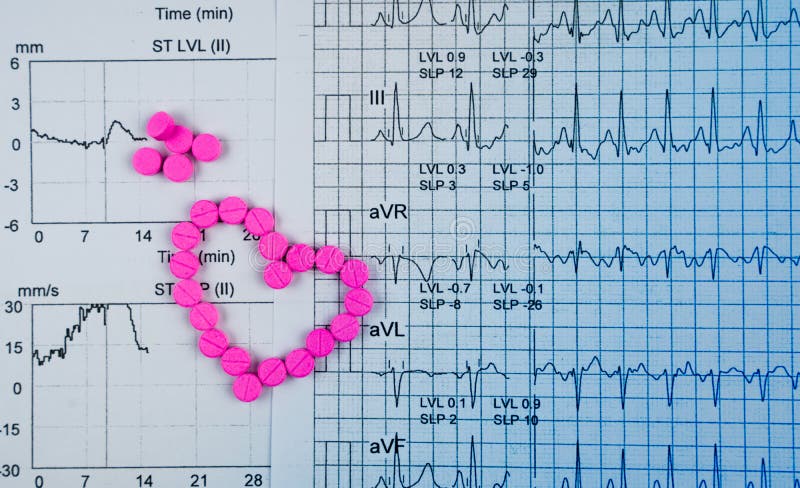 EKG or ECG Electrocardiogram graph report paper. EST Exercise Stress Test result and pink heart shape made from pills. Package promotion for heart check up in senior or elderly people concept.