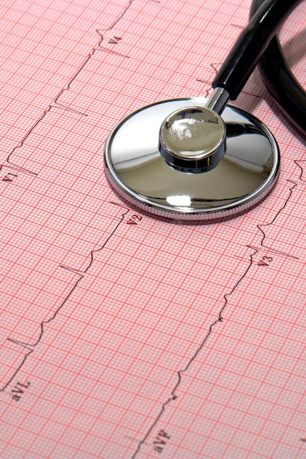 ekgelectrocardiogramläkarundersökning över stetoskopet arkivfoto ekgelectrocardiogramläkarundersökning över stetoskopet arkivfoto