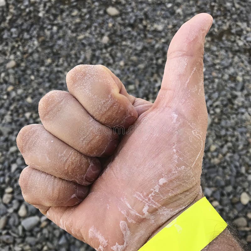 El Complejo De Lagos Salados. Los Espectáculos Del Hombre. La Mano Está Cubierta De Sal Después De Nadar En La Piscina De Sal. Imagen de archivo - Imagen de lagos, está: 158672757