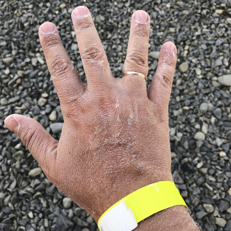 El Complejo De Lagos Salados. Un Hombre Muestra Su Palma Cubierta De Sal Después De Nadar En La Piscina De Sal. Una Muñeca En La Imagen de archivo - Imagen de lifestyle,