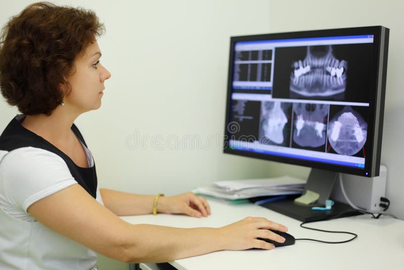 El dentista mira radiografías de la quijada el monitor del ordenador