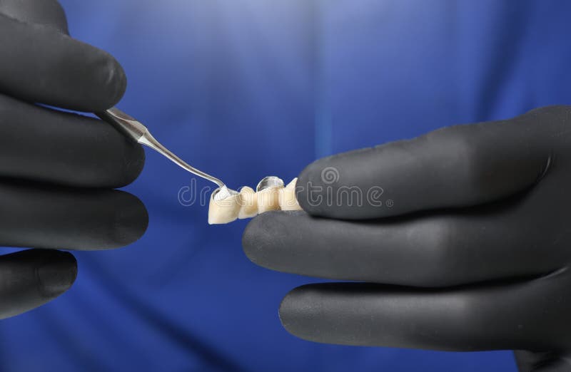 Mezcla De Cemento Dental Convirtiéndose En Relleno Sólido Bajo Espátula  Imagen de archivo - Imagen de tomar, cemento: 217702777