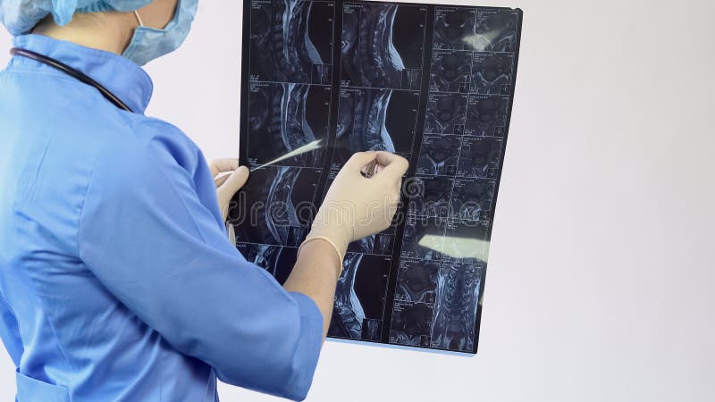 El doctor de sexo femenino que analiza la espina dorsal paciente deshuesa la radiografía, tratamiento del dolor de espalda, hospi imagenes de archivo El doctor de sexo femenino que analiza la espina dorsal paciente deshuesa la radiografía, tratamiento del dolor de espalda, hospi imagenes de archivo