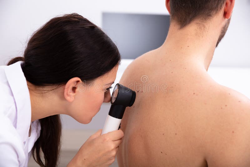 Female Doctor Examining Pigmented Skin On Man`s Back With Dermatoscope. Female Doctor Examining Pigmented Skin On Man`s Back With Dermatoscope