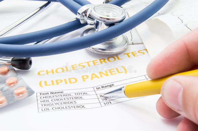 General practitioner checks cholesterol levels in patient test results on blood lipids. Statin pills, stethoscope, cholesterol test and hand of doctor, pointing to increasing its level in concept. General practitioner checks cholesterol levels in patient test results on blood lipids. Statin pills, stethoscope, cholesterol test and hand of doctor, pointing to increasing its level in concept