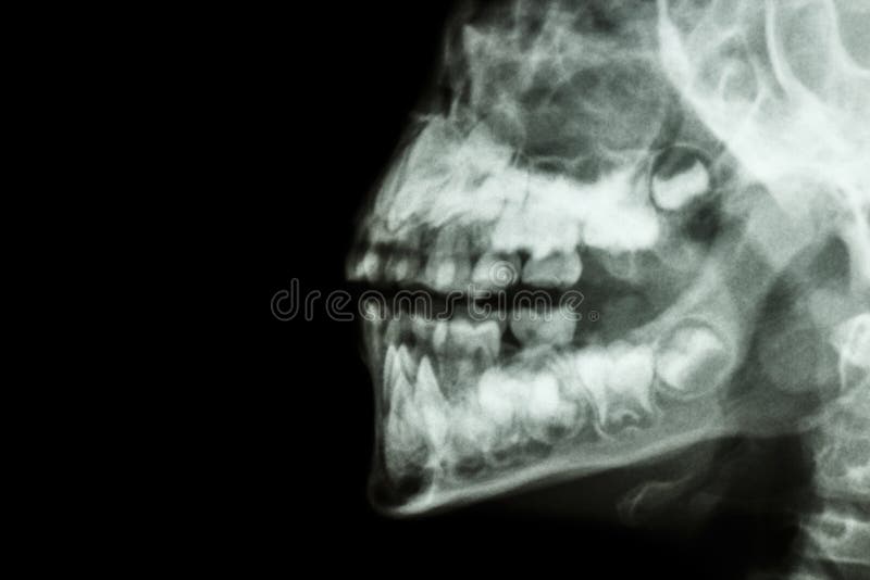El mandíbula y los dientes del ser humano