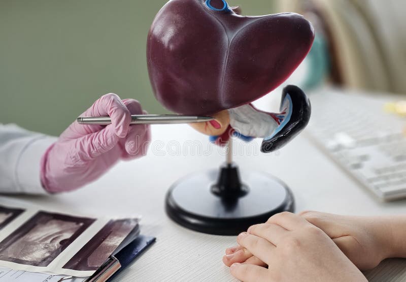 El médico muestra un modelo de cómo funciona el sistema hepático médicos explicando los síntomas y el tratamiento a los pacientes fotos de archivo