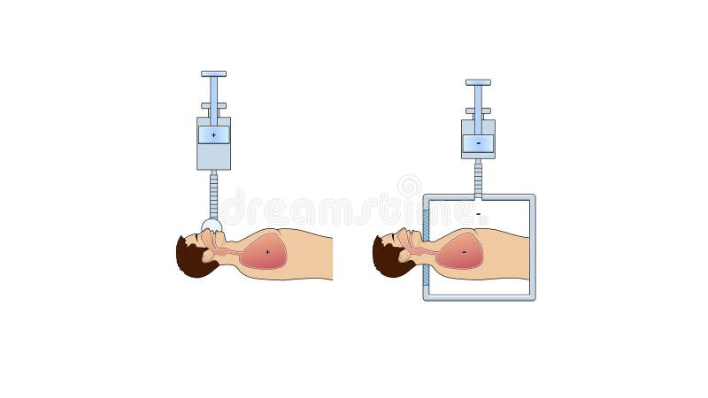 El sistema respiratorio de los seres humanos y la anatomía de las vías respiratorias Principio de ventilación pulmonar artificial