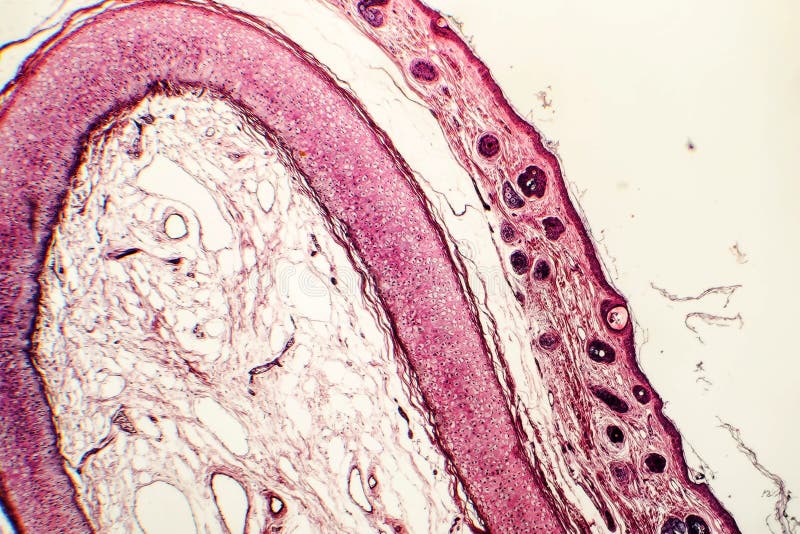 Elastic Cartilage of Human Outer Ear Stock Photo Image of