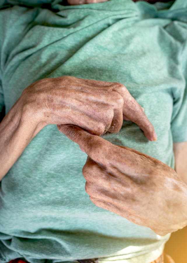 260 Bent Fingers Hand Stock Photos Free & RoyaltyFree Stock Photos