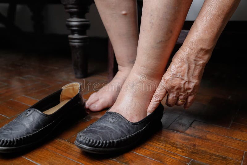 Elderly Woman Swollen Feet Putting On Shoes Stock Photo Download Image ...