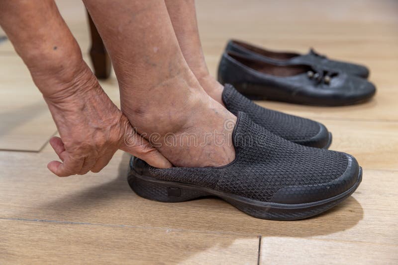 Elderly woman varicose veins feet puts on a shoes at home.