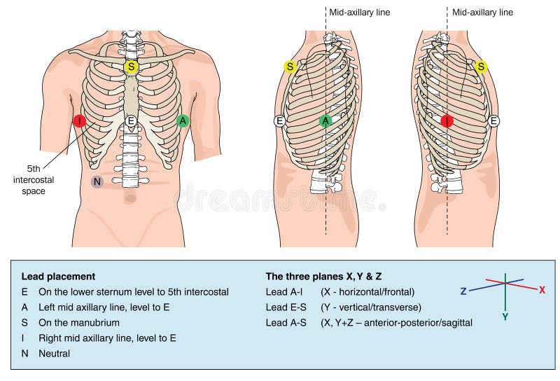 Ecg 10 Lead Placement Chart