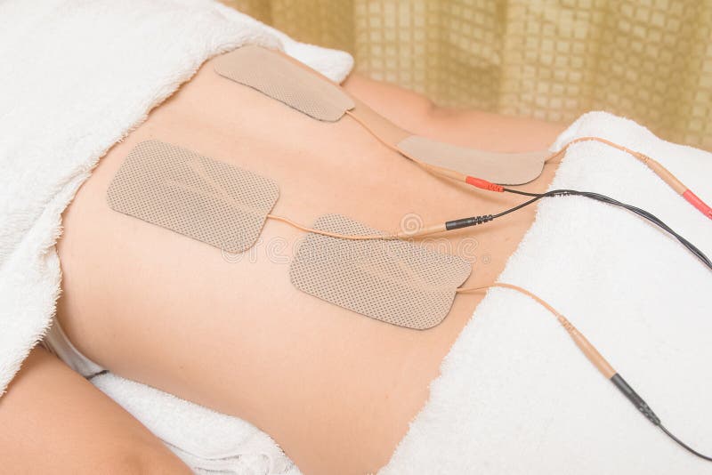 Electrodes of Tens Device on Shoulder, Tens Therapy Stock Image Image
