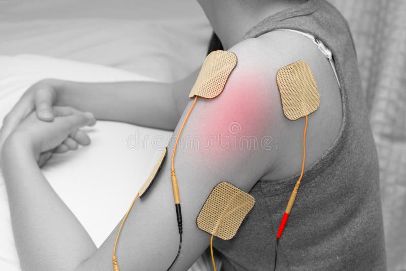 Electrodes of Tens Device on Shoulder, Tens Therapy Stock Image Image