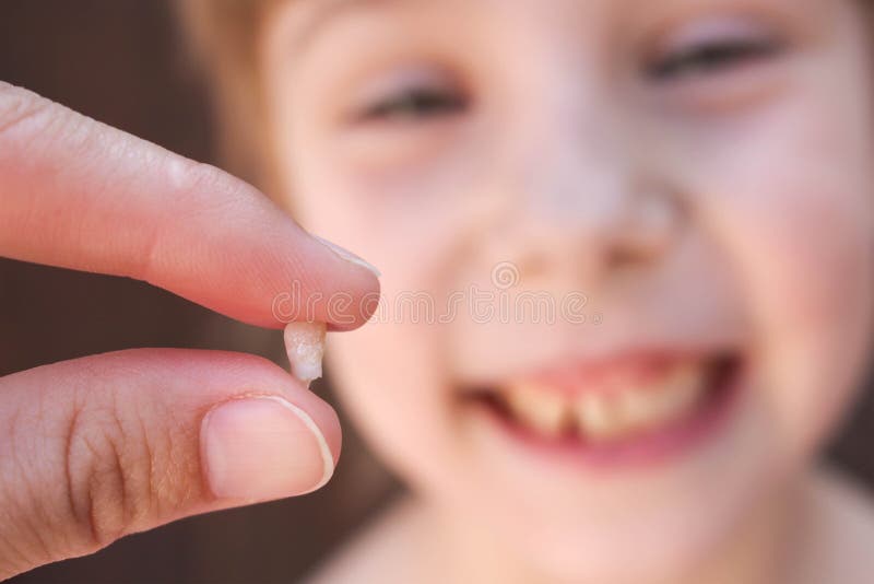 Em 6 anos a criança idosa perdeu o dente de bebê A menina está guardando o dente em sua mão fotografia de stock Em 6 anos a criança idosa perdeu o dente de bebê A menina está guardando o dente em sua mão fotografia de stock