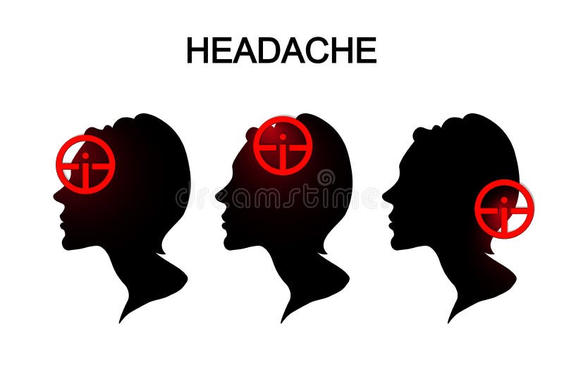 Illustration of headache in women. migraine. Illustration of headache in women. migraine.