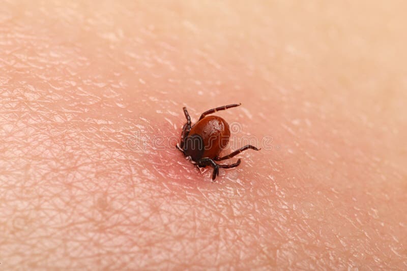 Encephalitis tick royalty free stock photos