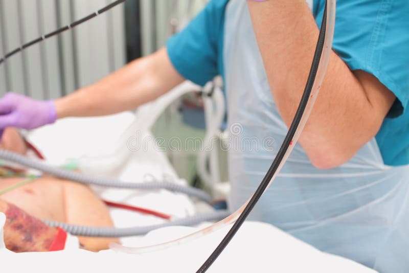 Endoscopytillvägagångssätt till den sjuka mannen i ICUEN arkivfoton Endoscopytillvägagångssätt till den sjuka mannen i ICUEN arkivfoton