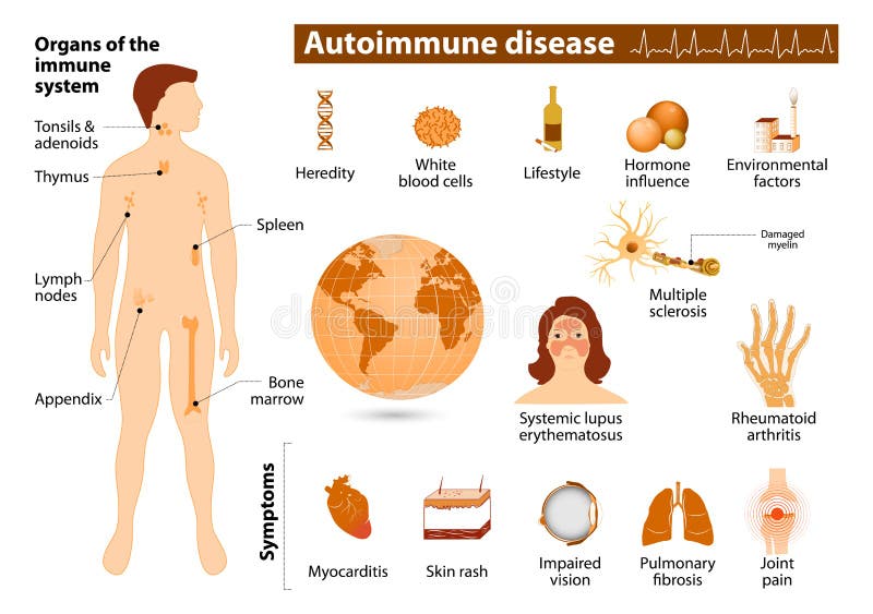 Enfermedad autoinmune infographic