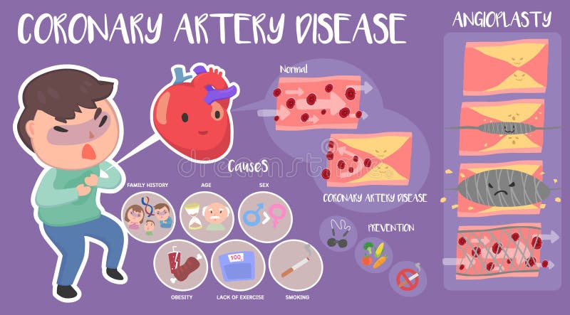 Enfermedad de la arteria coronaria infographic