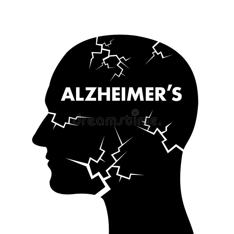Enfermedad del ` s de Alzheimer ilustración del vector Enfermedad del ` s de Alzheimer ilustración del vector