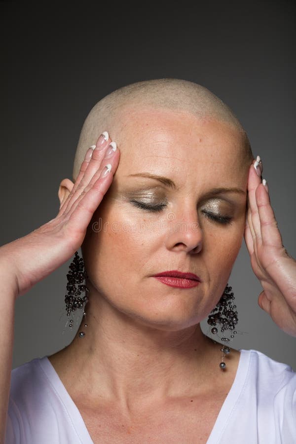 Enfermo De Cáncer Hermoso De La Mujer Sin El Pelo Imagen de archivo de enfermo Enfermo De Cáncer Hermoso De La Mujer Sin El Pelo Imagen de archivo