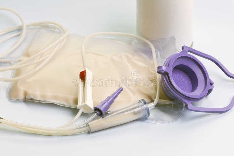 Enteral Feeding stock photo. Image of hand, equipment 48508258