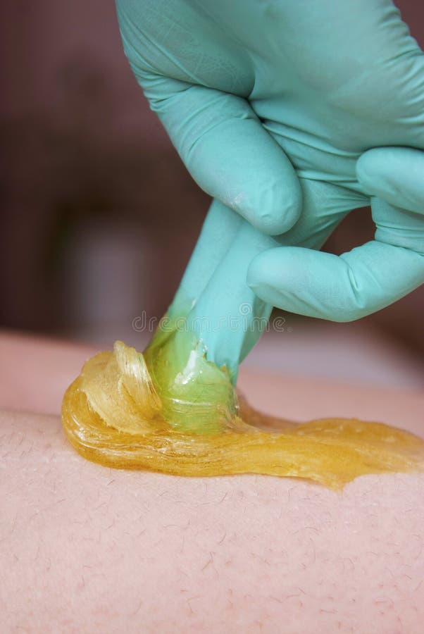 Enthaarendes Verfahren mit Sugar Paste Entfernen des Haares auf Women& x27; s-Beine schließen oben Vertikales Bild Zuckerenthaaru lizenzfreies stockbild Enthaarendes Verfahren mit Sugar Paste Entfernen des Haares auf Women& x27; s-Beine schließen oben Vertikales Bild Zuckerenthaaru lizenzfreies stockbild