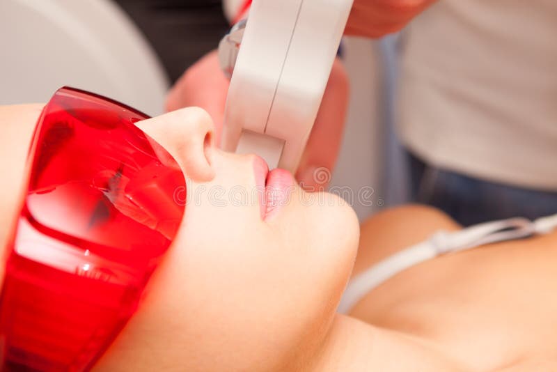 Epilation do laser imagens de stock royalty free Epilation do laser imagens de stock royalty free